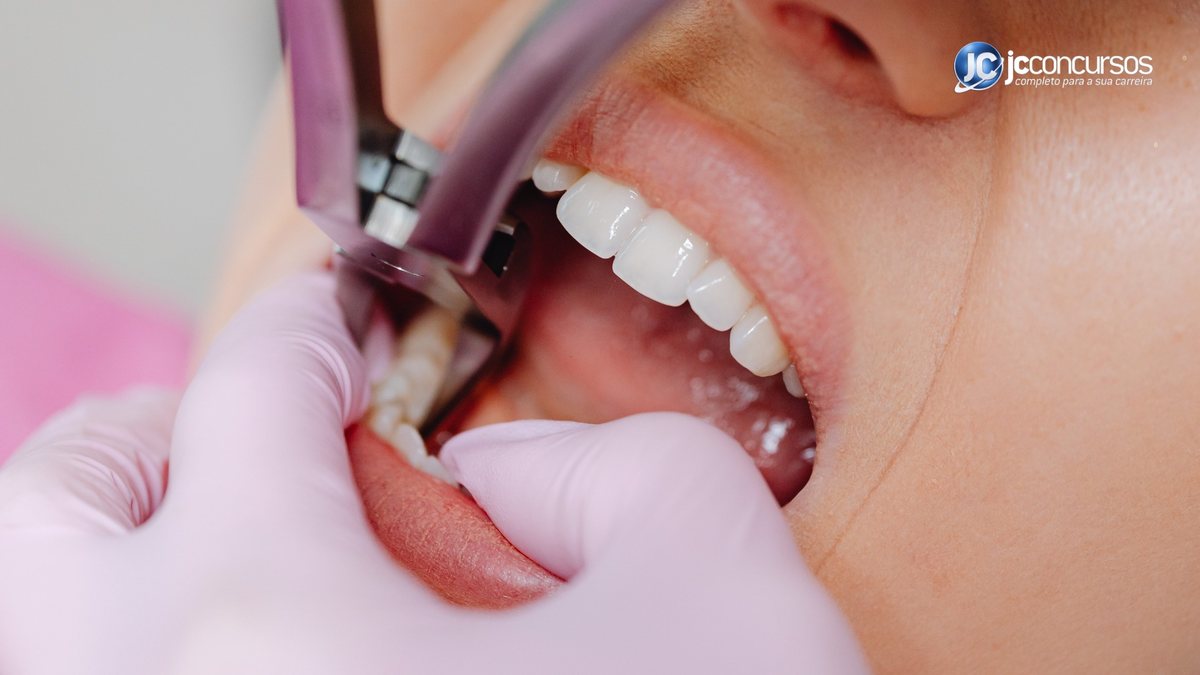 Pessoa na cadeira do dentista com boca aberta - Divulgação