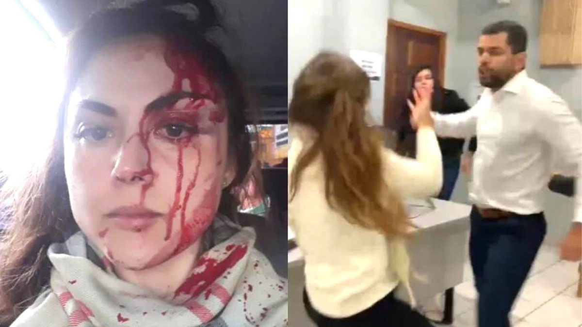 Procuradora agredida: sangue escorre no rosto de Gabriela após ataque