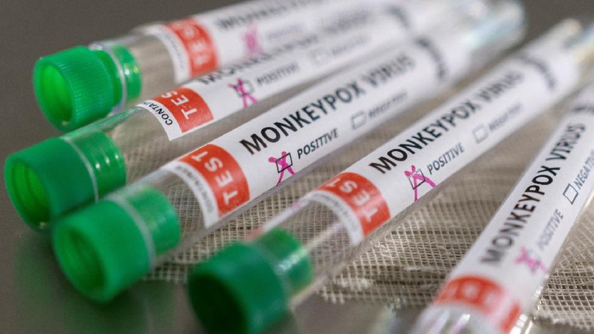 Quatro laboratórios do Brasil estão aptos a diagnosticar a varíola dos macacos - CDC/via Reuters
