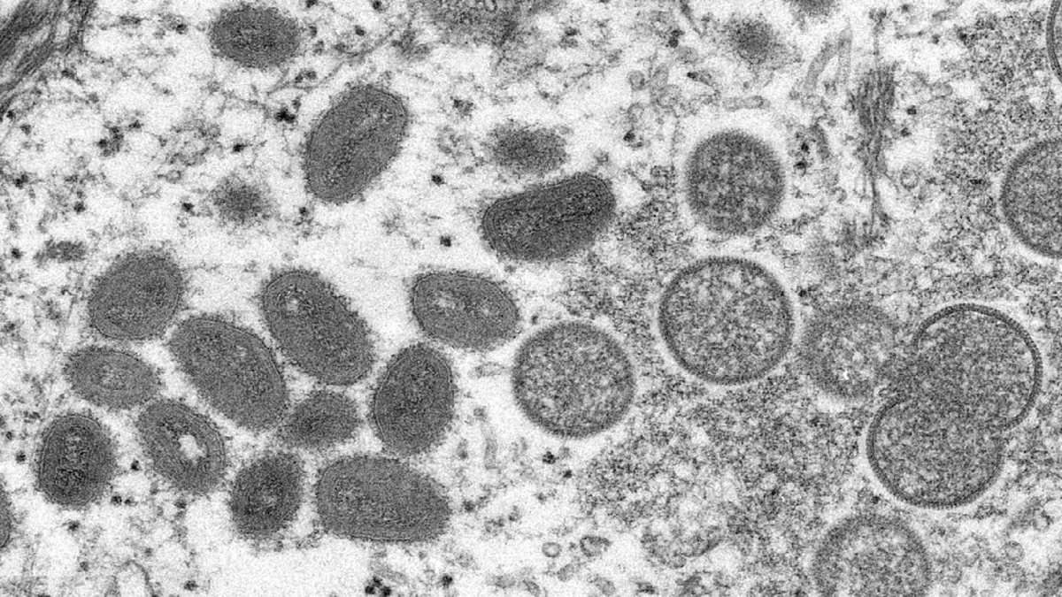 O primeiro caso da varíola do macaco na América Latina foi confirmado na Argentina nesta segunda-feira (23) - Centro de Controle de Doenças/Divulgação